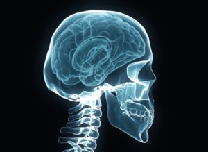 How Traumatic Brain Injuries Can Lead to Criminal Behavior